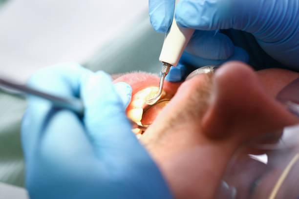 Best Emergency Broken Tooth Repair in Union Gap, WA